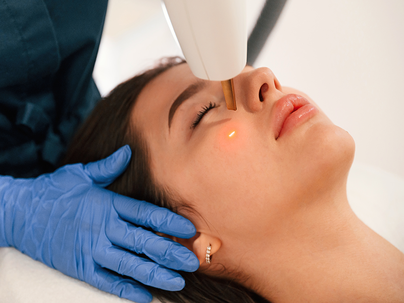 Ästhetische Medizin 2 Nahaufnahme einer Patientin während einer Laser-Skin-Resurfacing Behandlung
