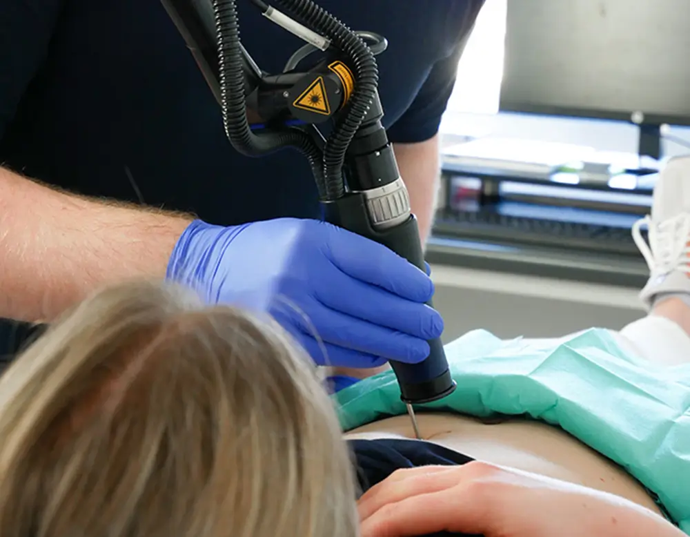 Über uns 16 Laser leistung